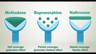 How Opioid Treatment Medications Work On Your Brain | San Diego Union-Tribune