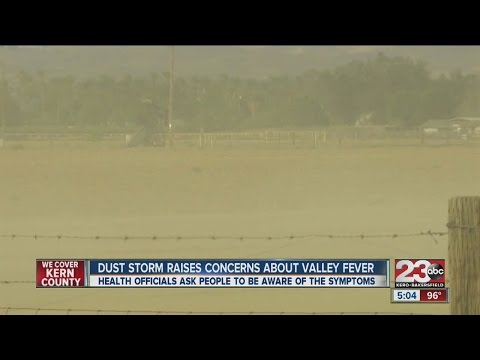 Dust storm raises concerns about Valley Fever