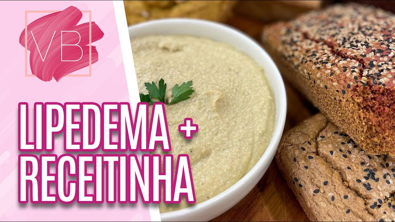 Saiba mais sobre o lipedema e aprenda uma recita de pão anti-inflamatório - Você Bonita (01/08/2022)