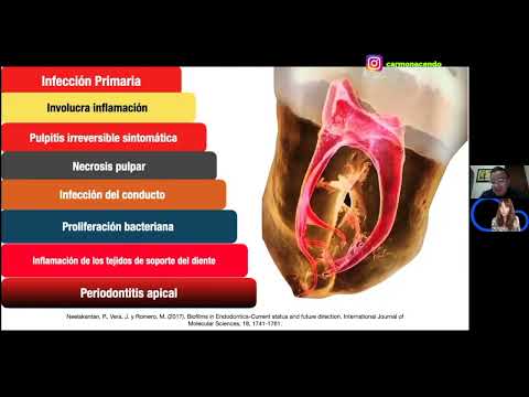 Terapia Endodóntica