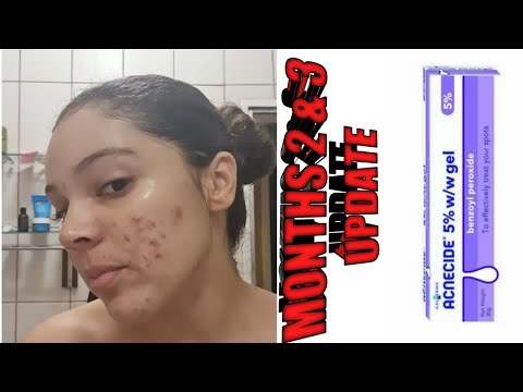 Benzac AC 5% (benzoyl peroxide)Gel 2 and 3 Month Update