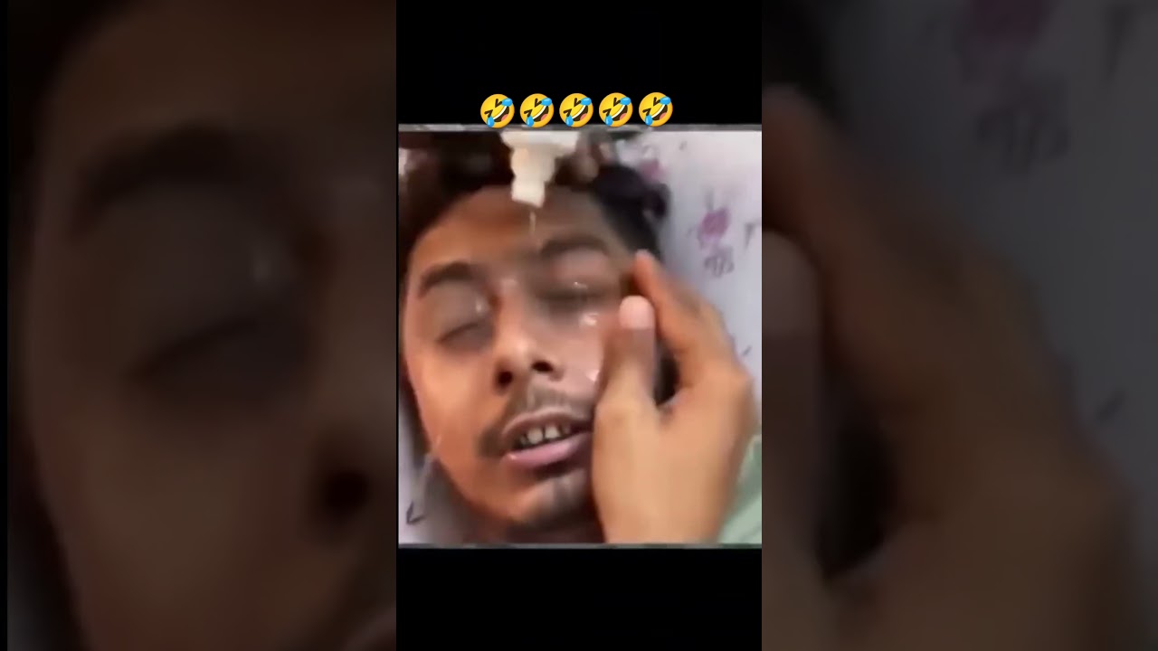 Eye Drops Effect #shorts