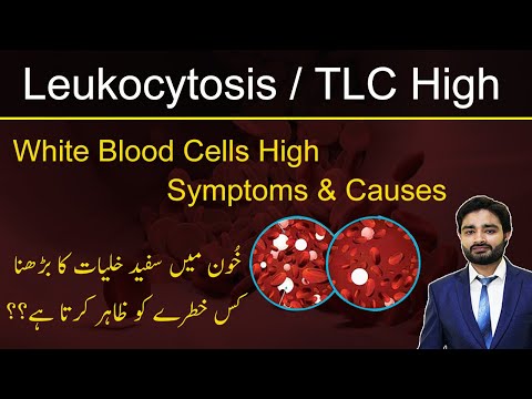 Leukocytosis/TLC High | White blood cells high symptoms & causes | خون میں وائٹ سیلز کیوں بڑھتے ہیں