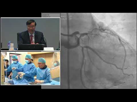 [TCTAP 2018] Coronary Symposium - Live Case Session III