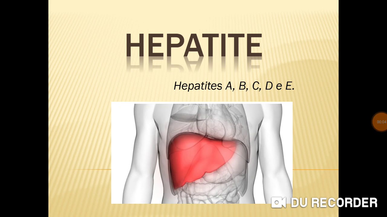 Hepatites - A, B, C, D e E
