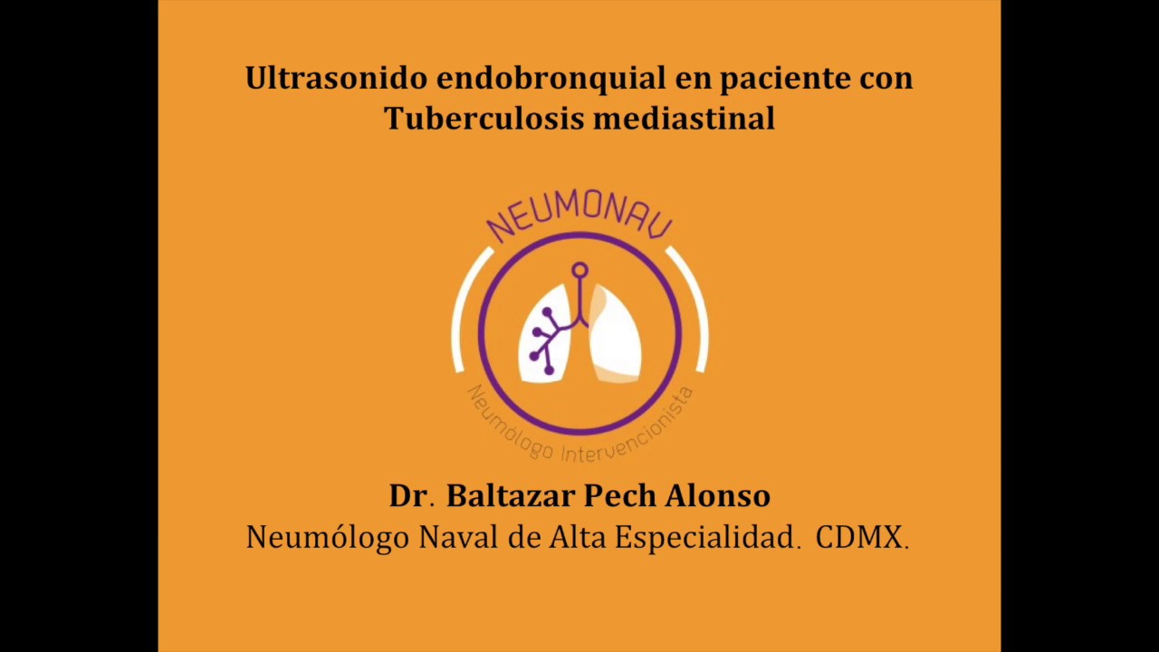 Baltazar Pech Alonso-27