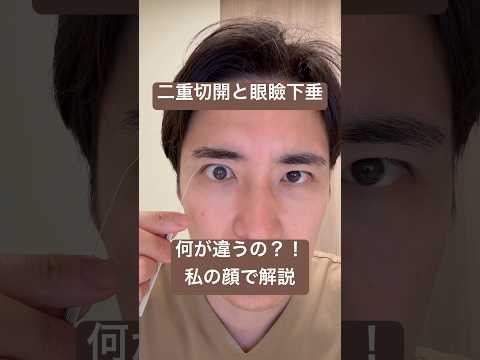 医学科 二重切開と眼瞼下垂の違いを解説