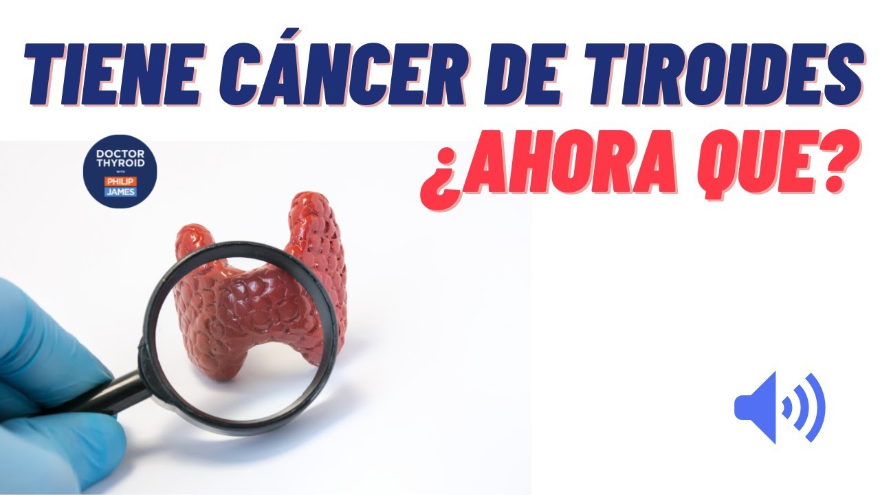 ¿Qué hago si tengo cáncer de tiroides?