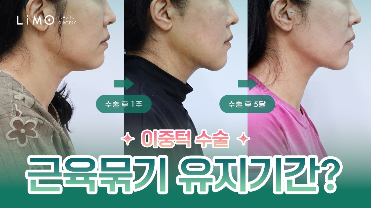 리모성형외과 유튜브 영상