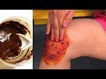 செலவே இல்லாமல் மூட்டு வலியை போக்க Easy Hom