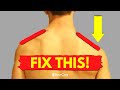 How to Fix a Low Shoulder at Home (NO EQUIPMENT!)