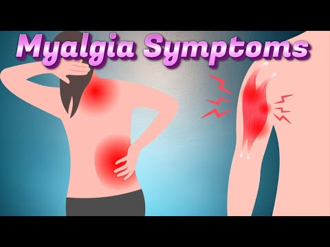 Myalgia Symptoms
