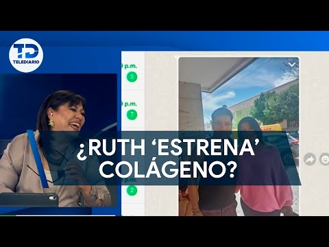 ¿Ruth Hernández 'estrena colágeno?