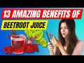 Drinking Beetroot Juice Every Day Will Do Wonders For Your Body
