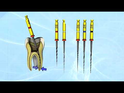 Hyflex CM Easy to Use Sequence Rotary Files | pinkblue
