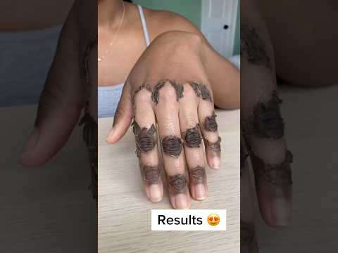 Remove Hand Tanning At Home ✅ #glowup #tanning #shorts #shortvideo