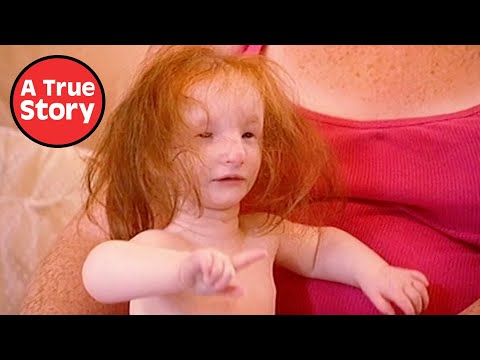 The Tiniest Girl in the World: The Full Documentary | A True Story