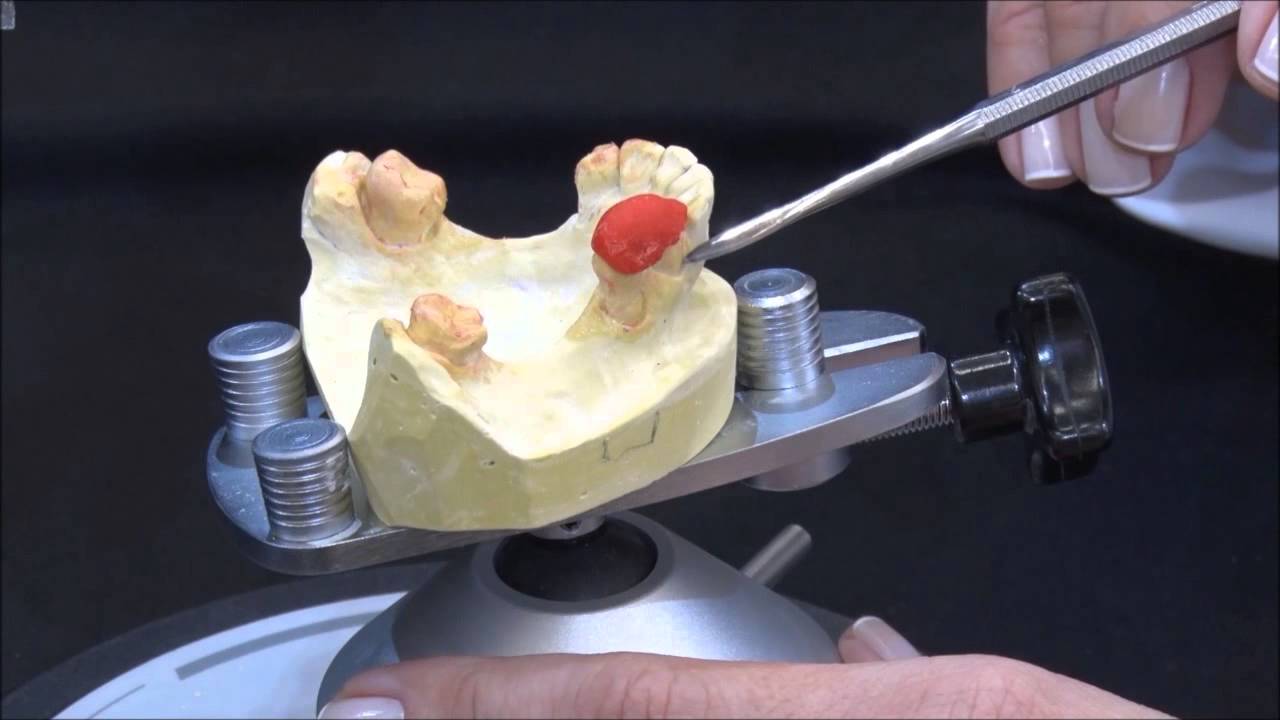 Guias de transferência para planos guias em PPR