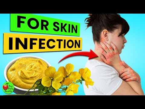 Mustard Benefits | 8 Health Benefits of Mustard You Didn’t Know! 🌿✨