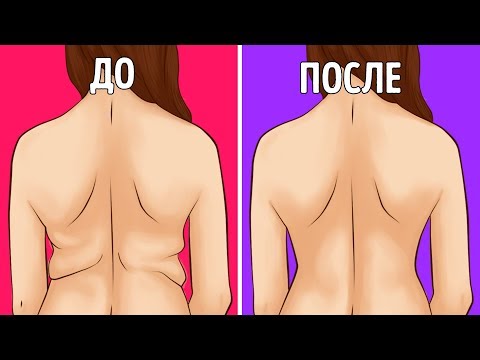Шейные упражнения при остеохондрозе Болит поясница и покалывает в матке