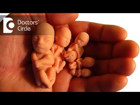 What are the options to terminate a 4 week pregnancy? - Dr. Premlata Subhash