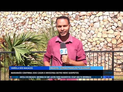 Maranhão confirma casos de Varíola dos Macacos e investiga suspeitos 15 08 2022