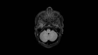 Case of the Day - 20 Nov 24