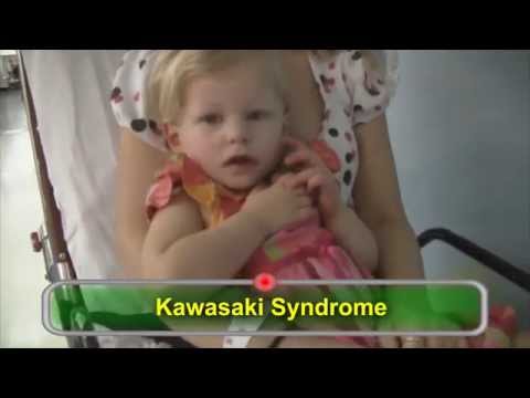 Kawasaki Disease
