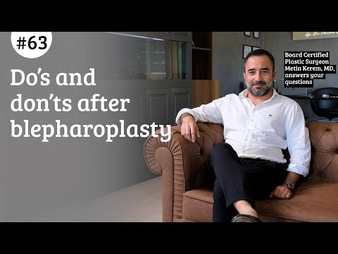 Do’s and don’ts after blepharoplasty
