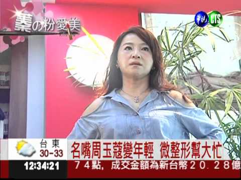 微整形變臉! 電波拉皮有適用年齡