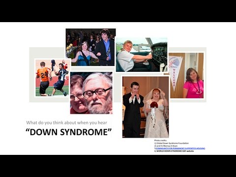 Living with Down Syndrome: Parents Health Professionals and Personal Perspectives
