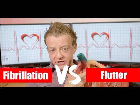 Afib vs Aflutter: What's the difference?