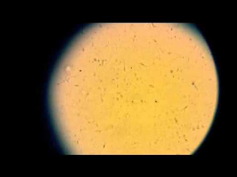 馬の精子　×６００ (Horse semen property test)