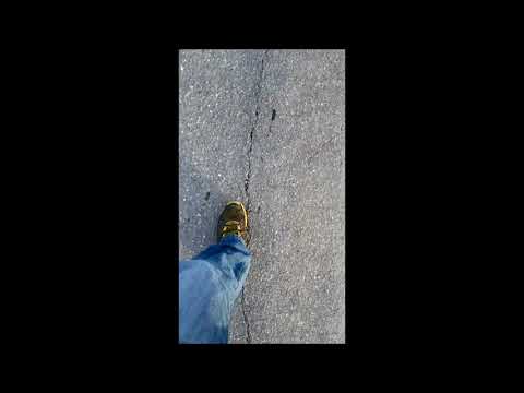 Metatarsalgia and Morton s Neuroma Evaluation and Treatment