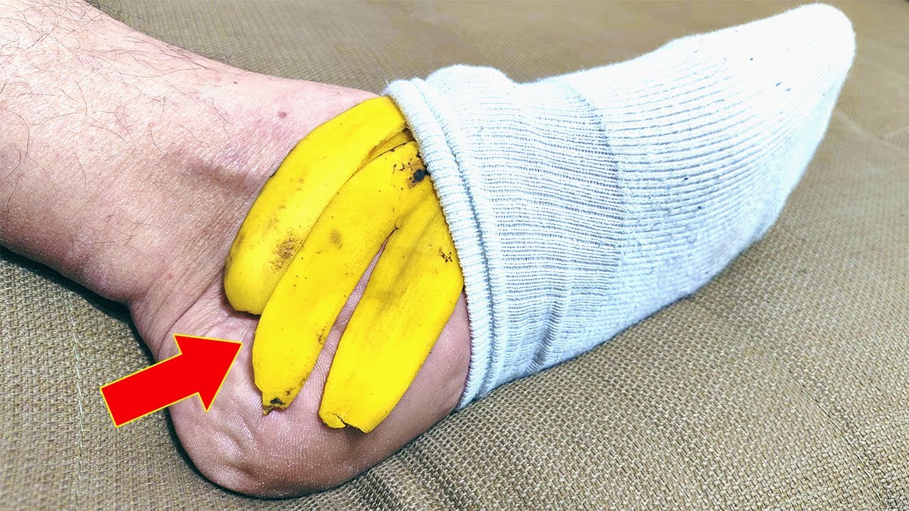 Put banana peel on your feet and don't spend more at the pharmacy (Did you know that?)