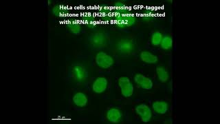 BRCA2 antagonizes classical and alternative nonhomologous end-joining to prevent gross genomic