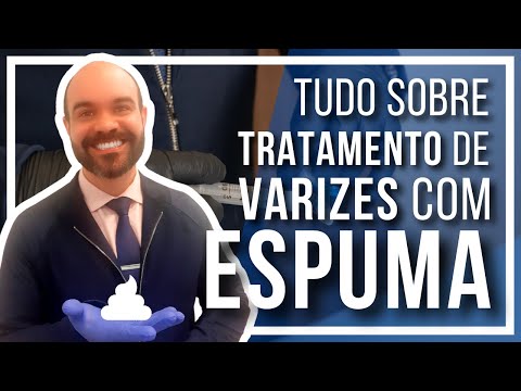 🔴Everything about Varicose Vein Treatment with Foam [Large varicose veins without surgery]