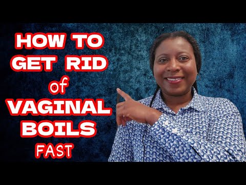 How To Get Rid of Vaginal Boil Fast | Vaginal Boil Treatment with Simple Home Remedies