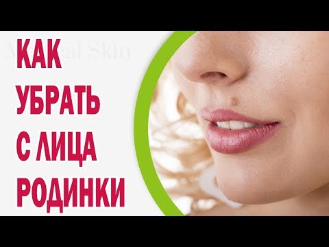 Отбеливающая маска для лица лимон сметана Отбеливает пятен на лице перекисью водорода
