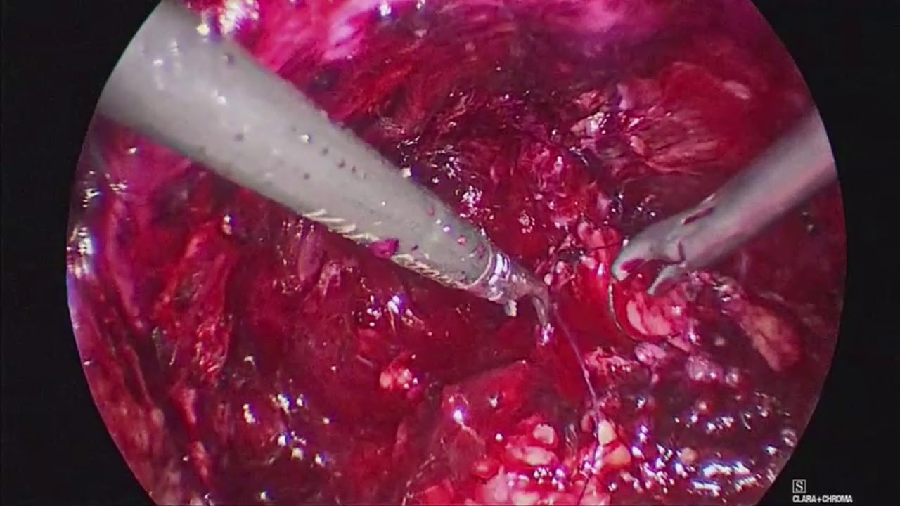 Humberto Romo Valdes-33