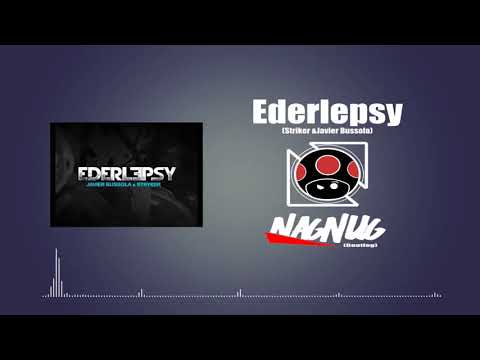 Javier Bussola & Dj Striker   Ederlepsy (NAGNUG Bootleg)