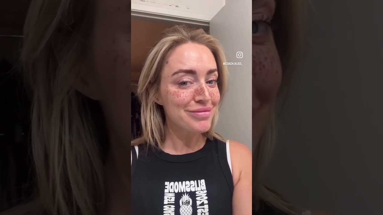 FRECKLES⁉️ #relatable #comedyshorts