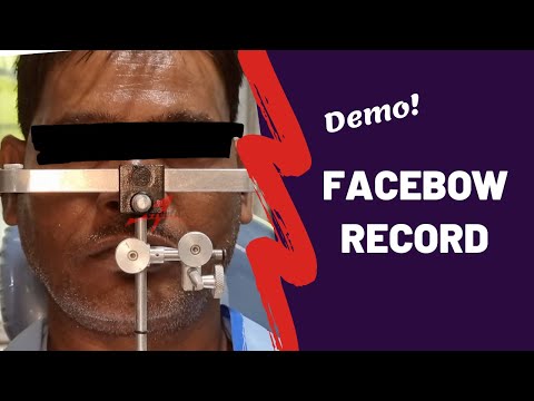 Facebow Record & its Transfer | Clinical DEMO