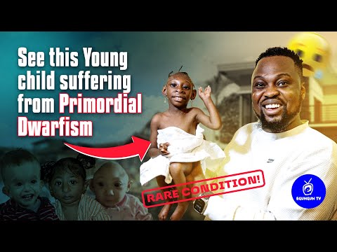 A 7Year Old Girl That Refuse To GROW Suffering From PRIMORDIAL DWARFISM SYNDROME // EGUNGUN OF LAGOS