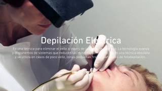 CONSEJOS ESTELA (19) Depilación Eléctrica