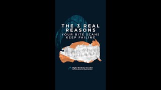 The 3 Real Reasons Your Bite Scans Keep Failing