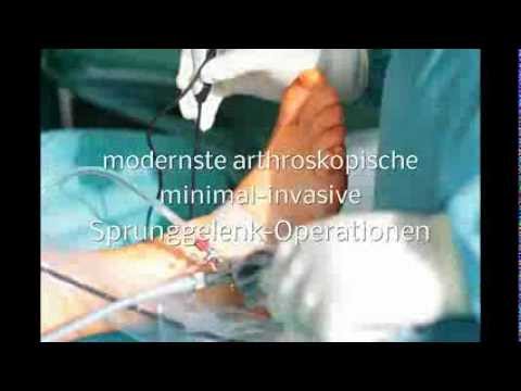 Hydrocortison aus Gelenkschmerzen Fessel, die Schmerzen in der Schulter und Nacken