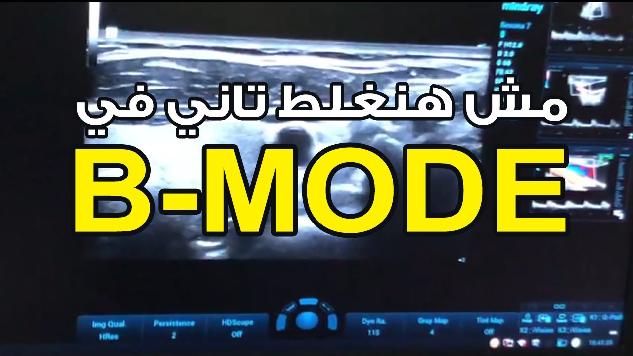 You won't make a mistake again for B-Mode