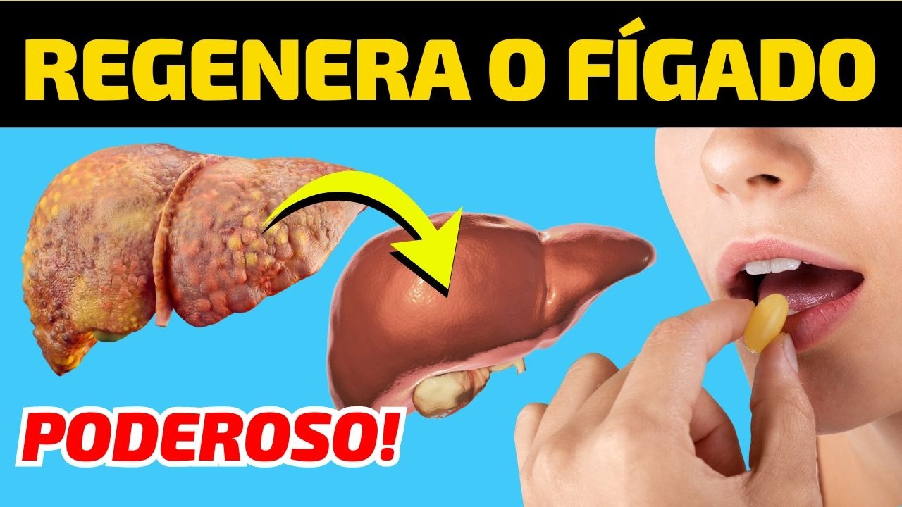 2 SUPLEMENTOS QUE JUNTOS PODEM SALVAR SEU FÍGADO (Reduzir a Gordura no Fígado) Dr Alain Dutra
