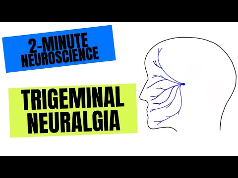 2-Minute Neuroscience: Trigeminal Neuralgia